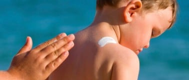 After-sun care being applied to a young boy's back at the beach